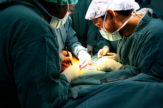 On Longer Lives and Longer Deaths